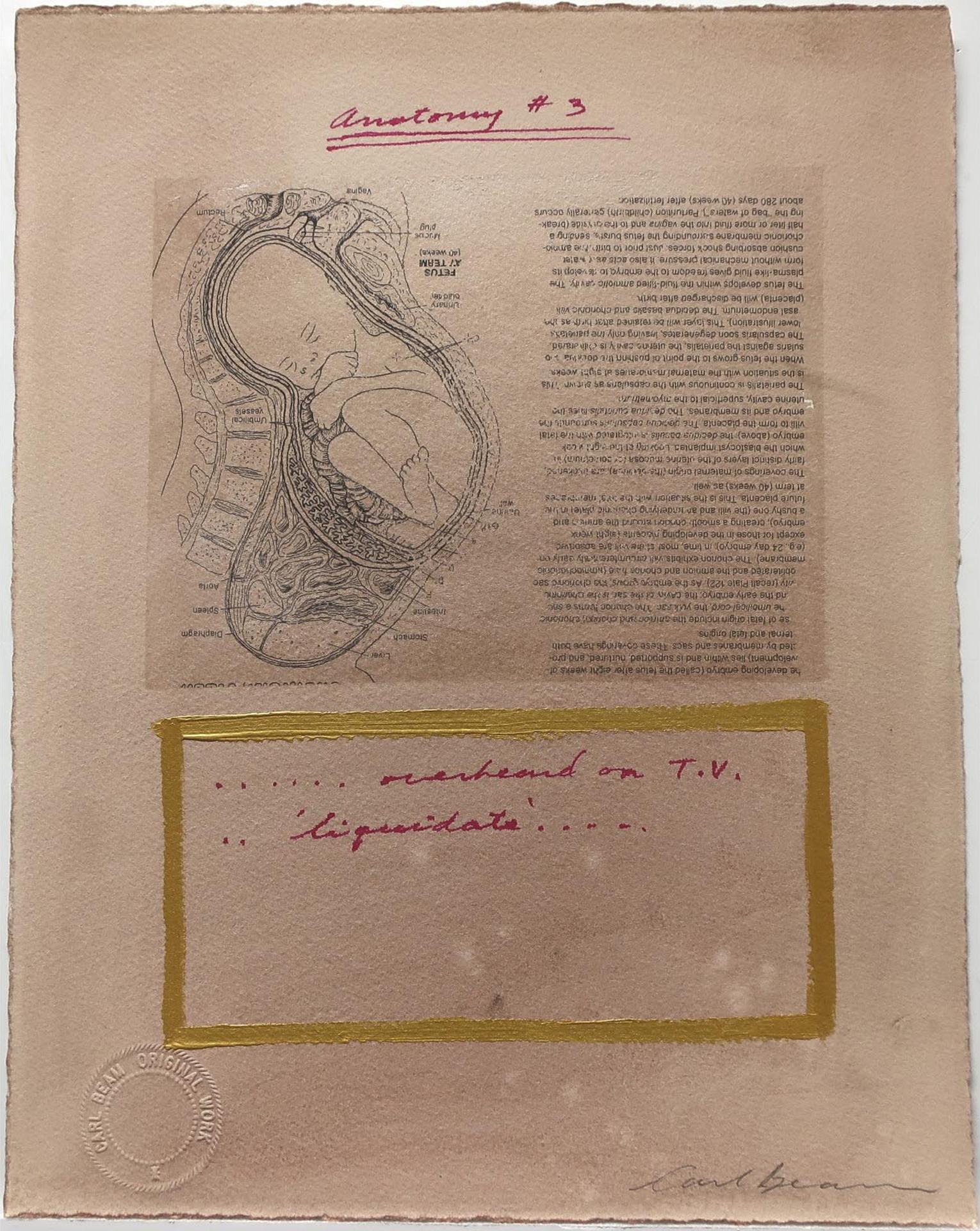 Carl Beam (1943-2005) - Anatomy #3 - ...Overheard On T.V..'liquidate'...