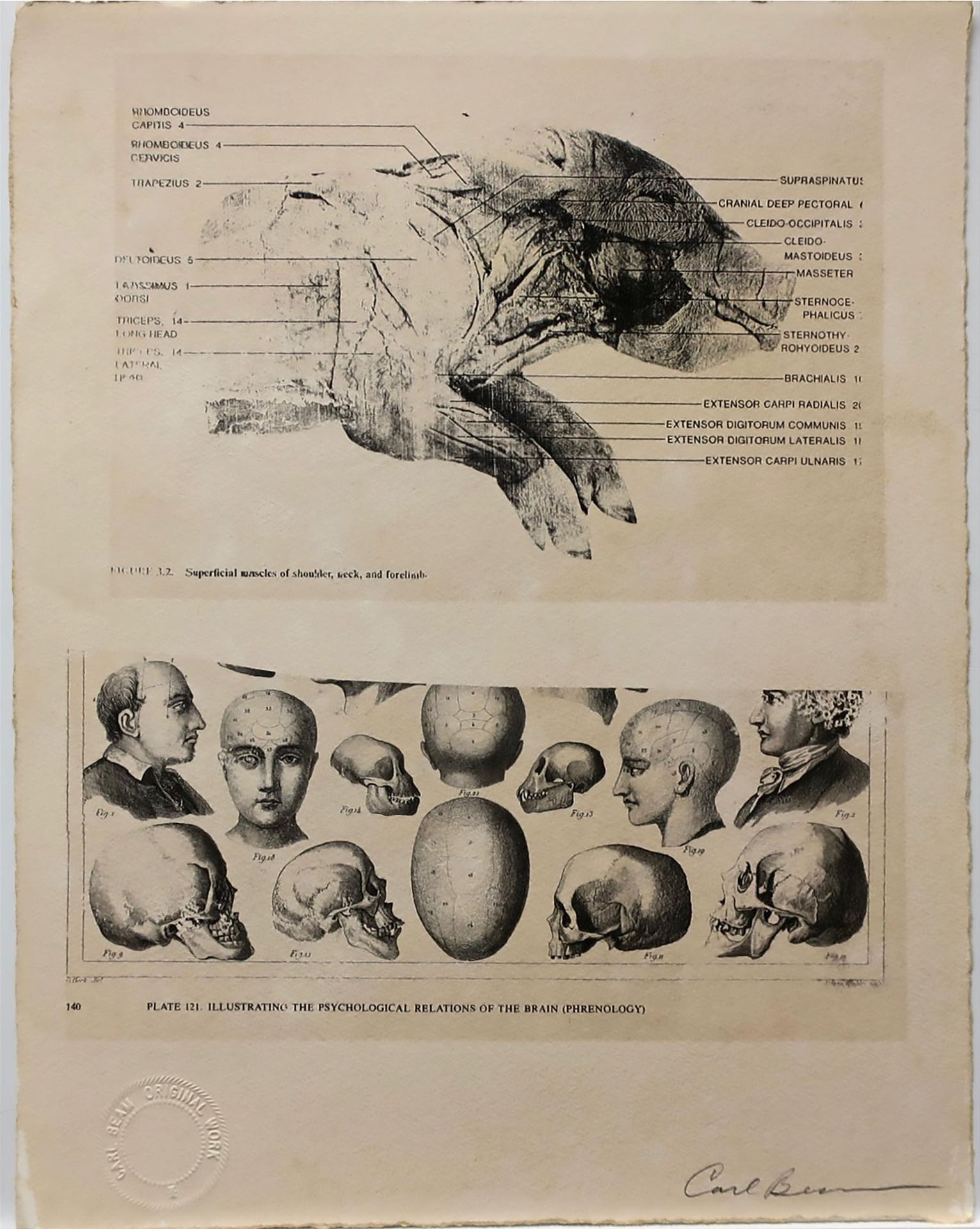 Carl Beam (1943-2005) - Superficial Muscles/Relations Of The Brain